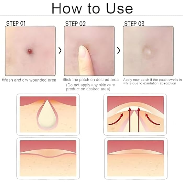 Acne Treatment Patch 💛😺️ We Apply to Pimples for 8 Hours to Dry Effectively ❤️ Quickly Absorb Bacteria in Pimples and Prevent Scars ❤️ Stay Put Even With Water Exposure.(24 Sticks) - Image 4