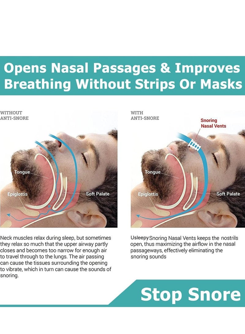 XiuWoo Anti Snoring Silicone Nasal Stopper 8 Set - Image 5