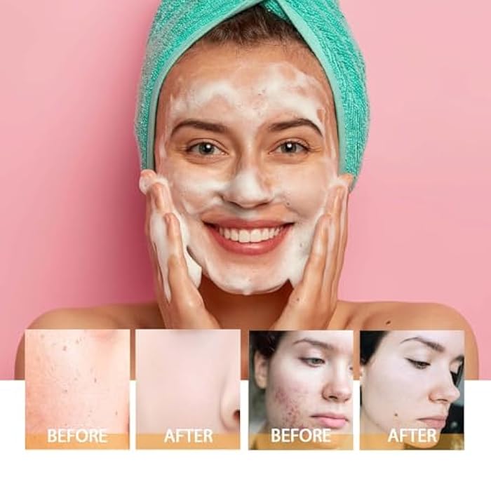 JISKG 2 Pcs Turmeric Facial Cleanser, Glow Wash Turmeric Face Wash With Brush, Deep Cleansing Exfoliating for Women All Skin. - Image 5