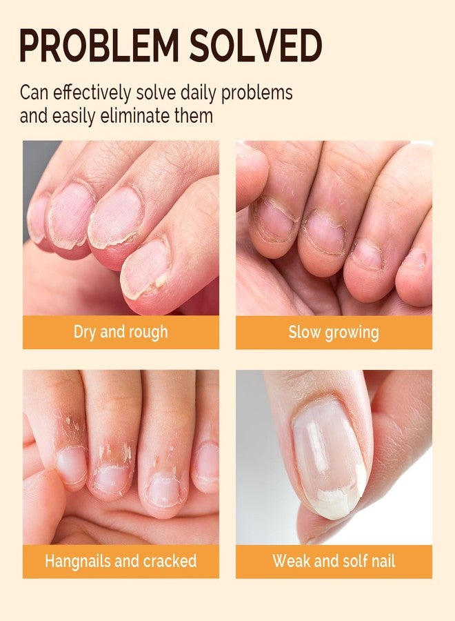 MelodySusie 6Pcs Cuticle Oil Pen Set,Nail Moisturizing Cuticle Oil Enriched with Vitamin E,Softens and Repairs Cuticles,Nail Strengthener,Protects Damaged Skin,Thin Nails,for Home and Salon Use - Image 2