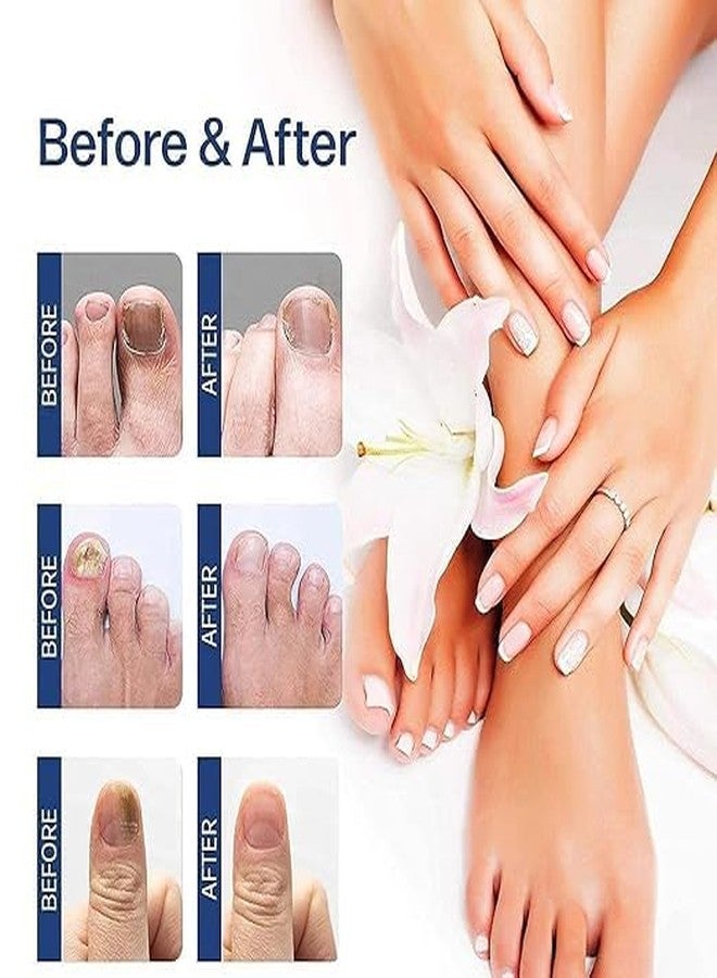 CRULLA Nail serum for nail repair, fungal infection, anti-infective removal, 100% Natural Profesional 30 ML Serum For Nail Strong, Supple and Shaped Nail Care Serum (30ml Pack Of 1) - Image 3