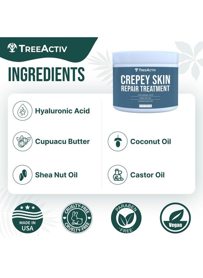 TreeActiv Crepey Skin Repair Treatment Original Formula, 8 Fl Oz, Firming Cream For Face & Neck, Skin Firming Lotion With Hyaluronic Acid, Crepey Skin Treatment To Address Dry Crepe Skin 