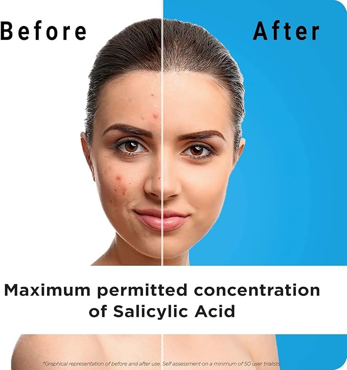 Exfoliating Face Wash with Salicylic Acid Pack of 3 Visible Results from Day 1 Purifies Unclogs Pores Reduces Oil Shine Cruelty Free Dermatologically Approved - Image 3