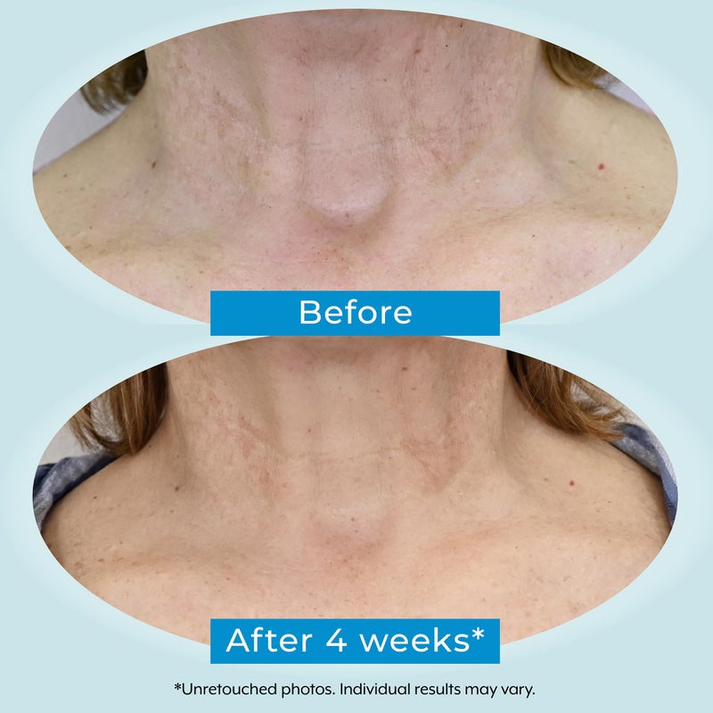 Plexaderm Dual Action Repair 1% Retinol Neck Cream. Anti Aging Cream with Retinol, Bakuchiol, and Hyaluronic Acid to Fight Wrinkles, Neck Lines and Crepey Skin, 1 fl. oz. - Image 4