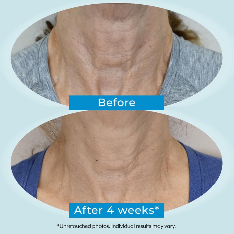 Plexaderm Dual Action Repair 1% Retinol Neck Cream. Anti Aging Cream with Retinol, Bakuchiol, and Hyaluronic Acid to Fight Wrinkles, Neck Lines and Crepey Skin, 1 fl. oz. - Image 5