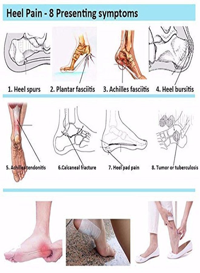 Aktive Support 560 Gel Heel - Small (White) - Image 3