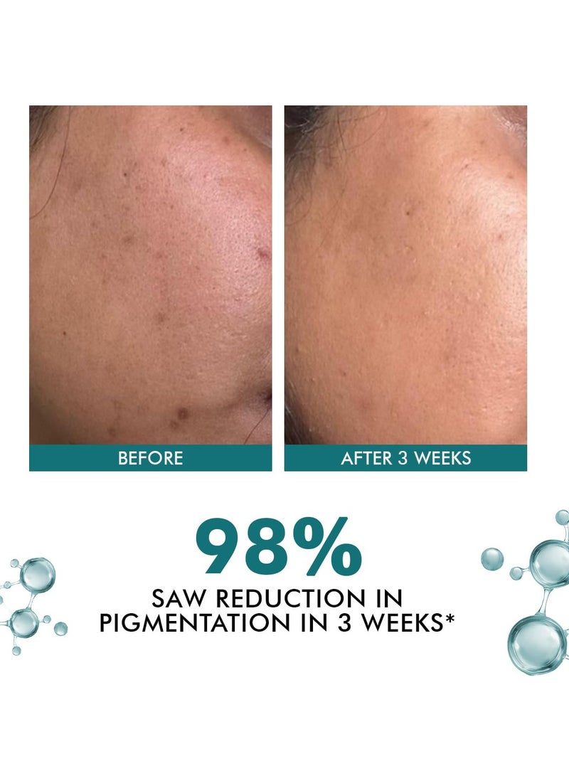 كيميائي واعي كريم الوجه بحمض الكوجيك من واكينس كيميست | 50 جرام | كريم حمض الأزيليك، كريم الآس للرجال والنساء، حمض النياسيناميد والترانيكساميك، كريم مضاد للتصبغ، يقلل من البقع الداكنة، لجميع أنواع البشرة - تروبيوم - Image 2