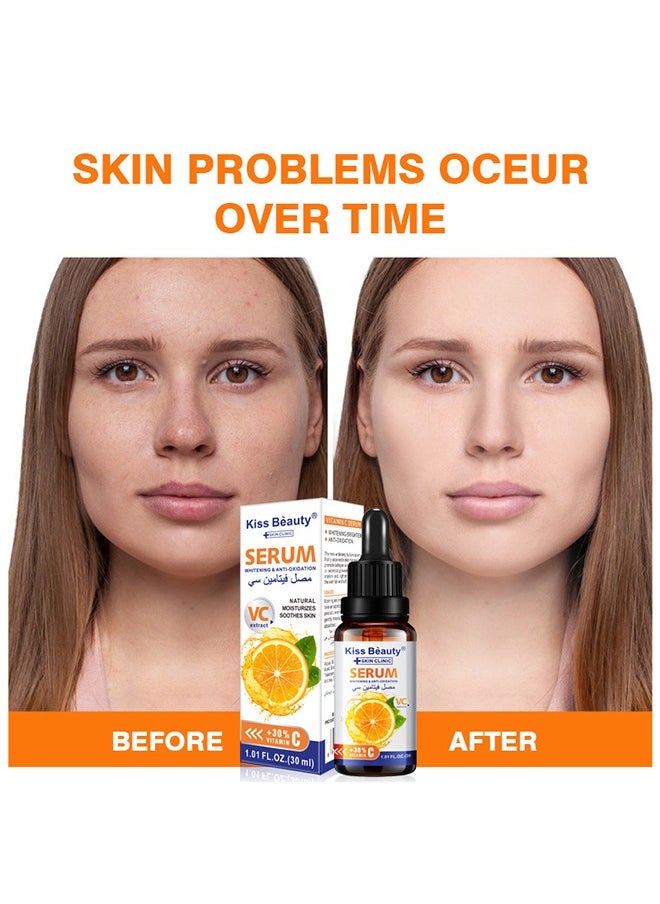 Kiss Beauty - VC Whitening & Anti-oxidation Serum,Natural Moisturizes Soothes Skin,Vitamin C Face and Eye Care  Help Fade Sun Spots Organic Anti-Aging Serum (30ml) - Image 1