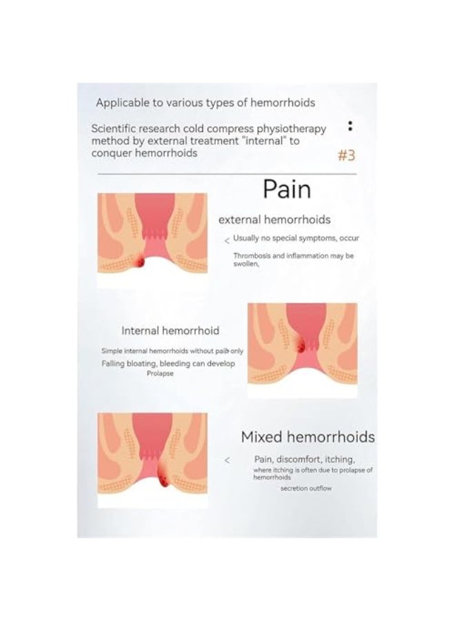 APDMP Hemorrhoid u0026 Fissure Cream, 20g Hemorrhoid Relief Cream, Fast Relief of Hemorrhoids and Anal fissures (1box) - Image 4