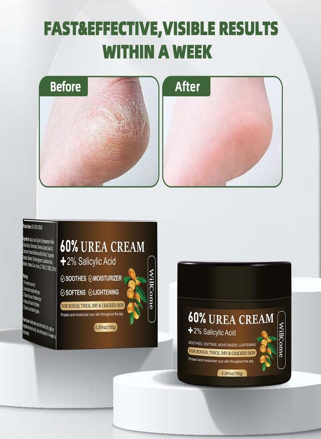 WillCome Urea Cream 60 Percent with 2% Salicylic For Feet Maximum Strength, Callus Remover Gel,Foot&Hand Care Cream Urea Lotion for Dry Cracked Heels and Feet Treatment& Repair,5.29 oz - Image 4