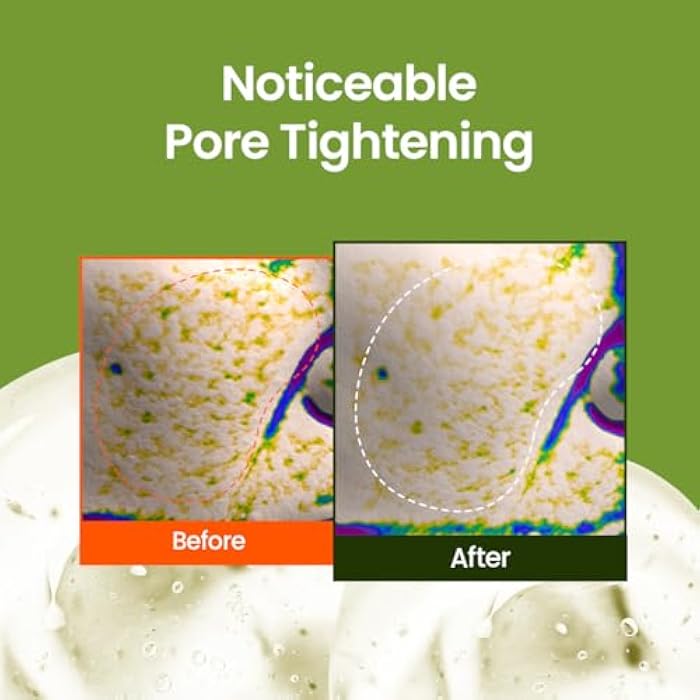 beplain Mung Bean Peptide Soothing Serum (1.69 fl.oz/50ml) | Niacinamide serum | Redness Relief | Hydration | Korean Skincare, For All Skin Types - Image 5