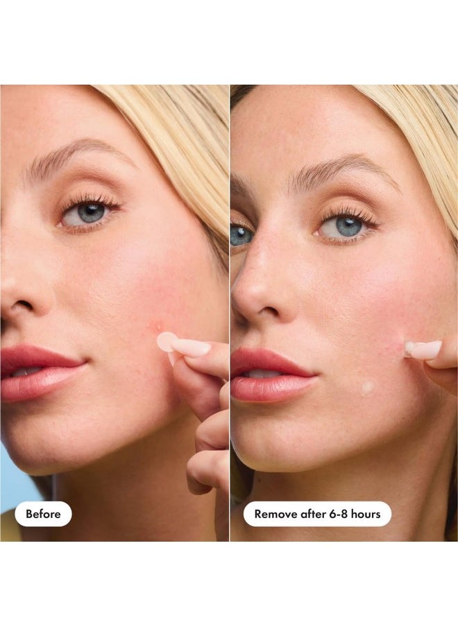 Hero Cosmetics - Mighty Patch™ Mini Invisible+ Patches Extra Small Daytime Hydrocolloid Acne Pimple Patches For Covering Zits And Blemishes Blends Into Skin And Barely There (30Ct 10Mm Patches) - Image 1