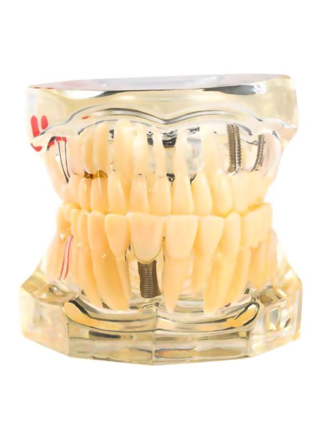 NIBEMINENT Pathologic Tooth Anatomy Model Toy - Image 1