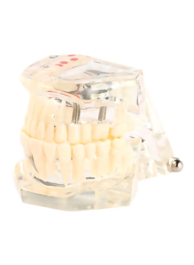 NIBEMINENT Pathologic Tooth Anatomy Model Toy - Image 2