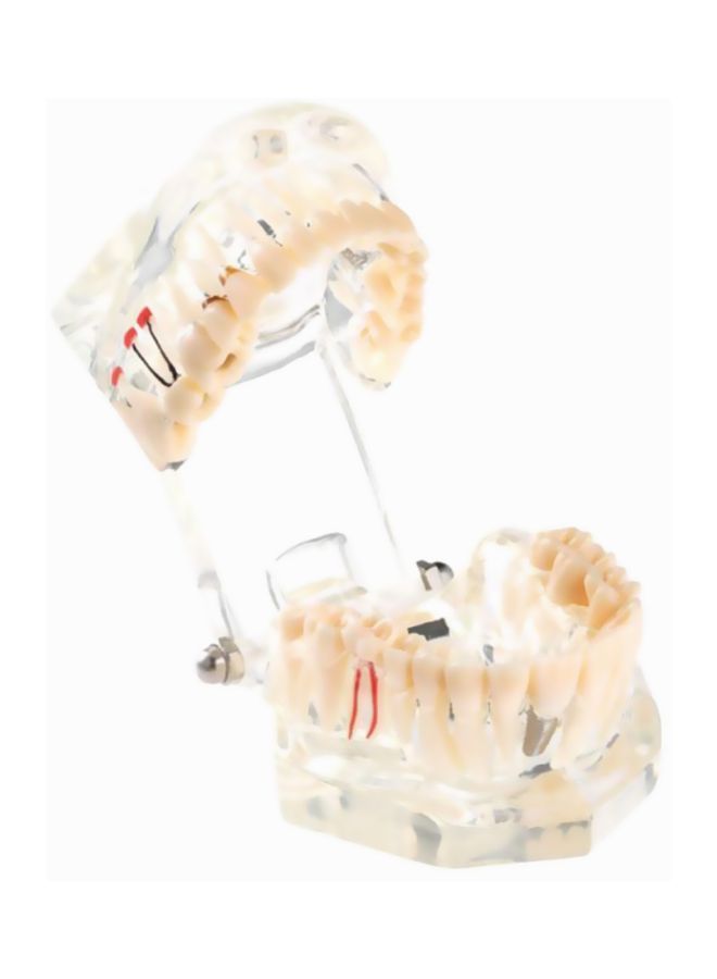 NIBEMINENT Pathologic Tooth Anatomy Model Toy - Image 3