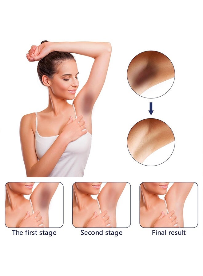 أوهو كريم تبييض فيتامين سي 50 جرام ، مفاصل منحنى الكوع الميلانين يضيء لون البشرة يحسن البهتان توهج كريم التبييض - Image 5