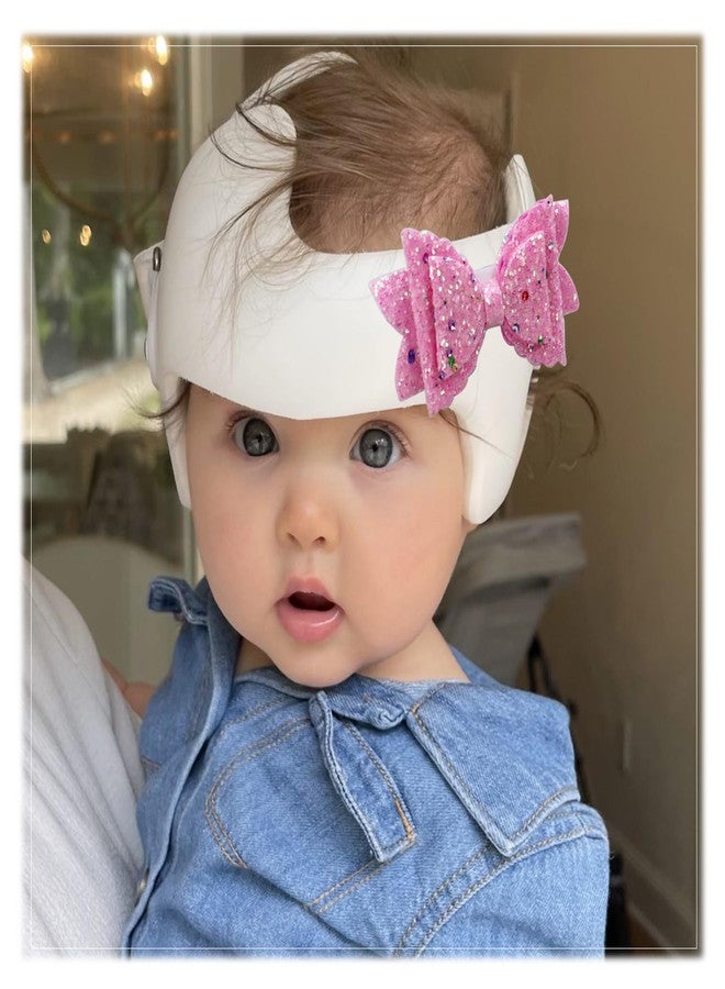 welsoon 3 Pack Bows for Cranial Helmet Bow Patch Cranial Band Bow Baby Cranial Helmet Bows Sparkle Helmet Bow Plagiocephaly Helmets Bow - Image 5