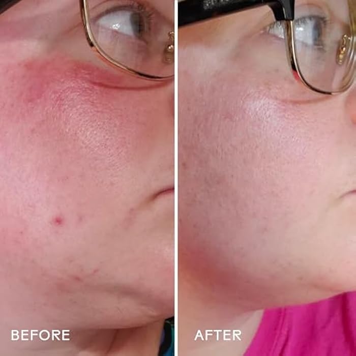 Three Ships - Radiance Grape Stem Cell + Squalane Ultra-Hydrating Cream | Hydrate, Soften, Replenish Skin | Cruelty-Free, Vegan, Paraben-Free, Sensitive Skin Safe (1.76 oz | 50 g) - Image 5