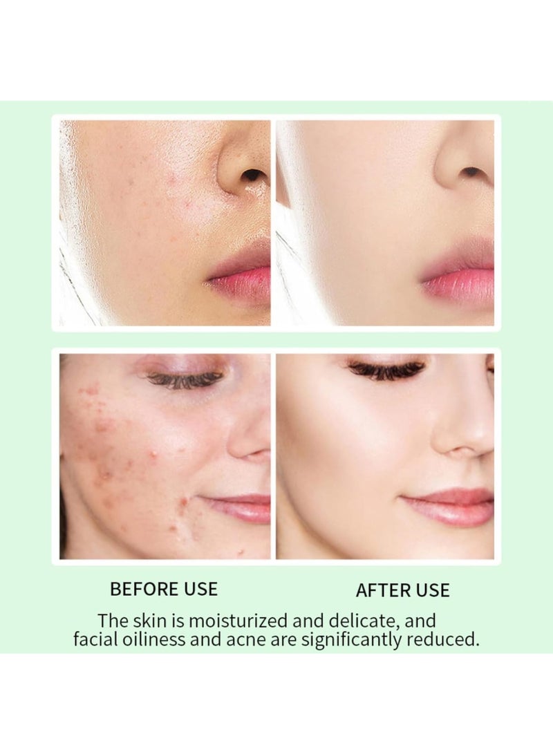 KASTWAVE KASTWAVE 2% Salicylic Acid Serum For Acne, Blackhead & Open Pores, Helps Reduces Excess Oil & Bumpy Texture, Minimize Pores, Without Over Drying  - Image 3
