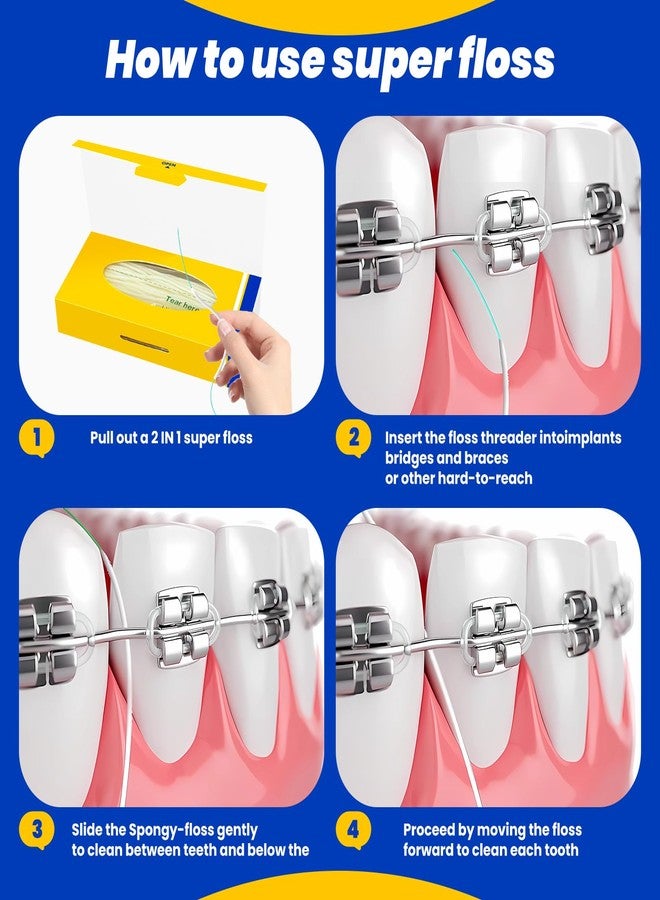COCOBURI Orthodontic Floss for Braces, Pre-Cut Floss Threaders for Bridges, Implants & Permanent Retainers, Built-in Stiffened End & Spongy Expanding Floss, 100 Counts (Pack of 2 - Image 3