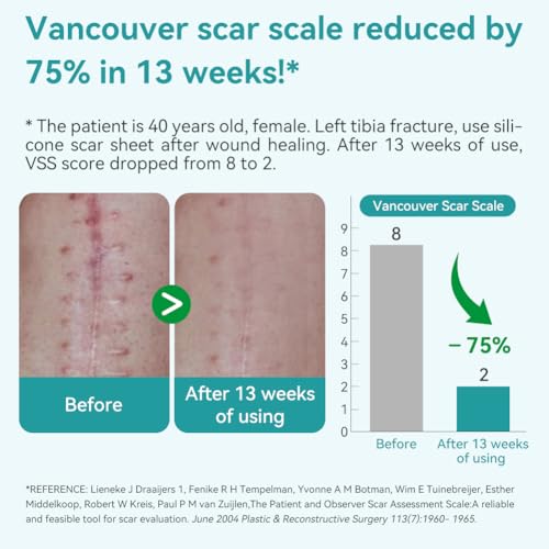 Dimora Medical Grade Silicone Scar Sheets - Ultra Soft Silicone Scar Tape (1.6”x120" Roll), Waterproof Scar Treatment for Surgical Scars, C Section, Tummy Tuck, Keloid Treatment - Image 4