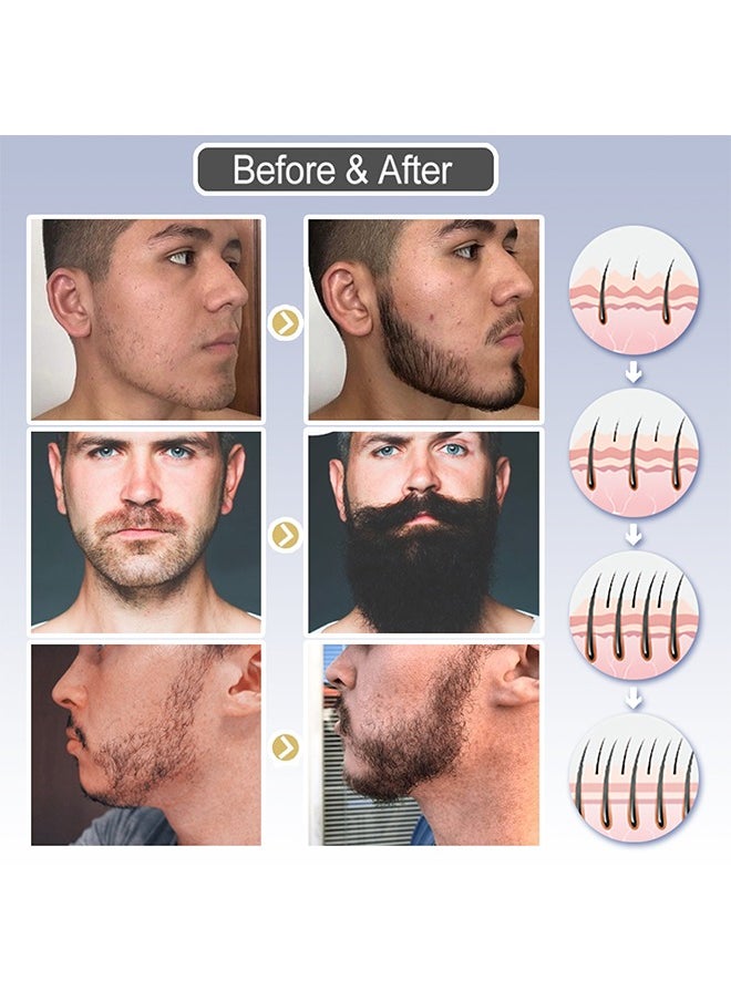 East Moon - Beard Growth Fluid - For Beard More Full And Thick - Beard Growth Serum Of Plant Extraction - Pure Natural Promote Beard And Hair Growth - Image 1
