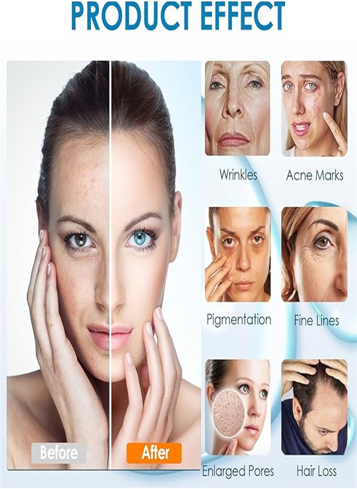 دي آر. بن - عبوة من 10 خراطيش حبر إبرة قلم Dr.Pen Microneedle - متوافقة مع طرازات Dr.Pen A9 وA11 وA8S وM8S، قطع غيار يمكن التخلص منها مع حربة (نانو-R دائري) - Image 1
