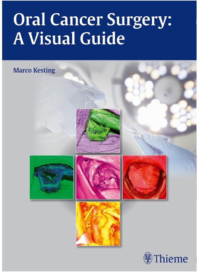 Oral Cancer Surgery: A Visual Guide 