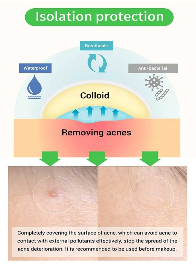 Breylee 22 Patches Acne Pimple Patch, Acne Healing Blemish Spot Treatmentmade with Tea Tree, Diminishinflammation, Adjustgrease Secretion, Relieveskin and Acceleratewound Healing, Suitable for All Skin Types  - Image 3