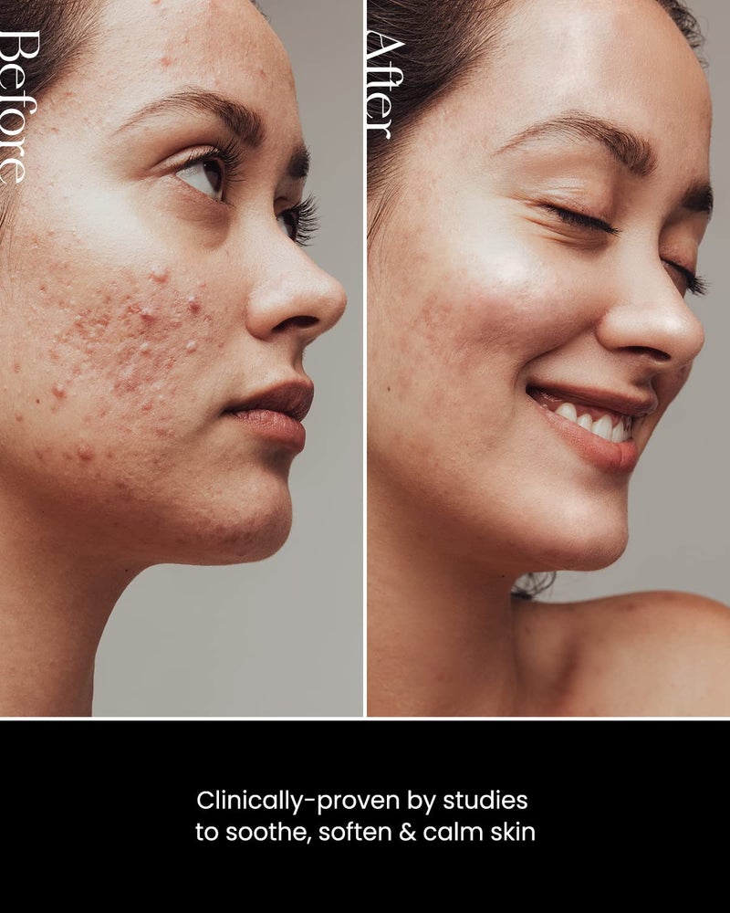 SON&PARK Beauty Water 340ml (11.49 fl. oz) | Multi-Purpose Toner for Oil Control Hydrating Exfoliating Skincare Daily Cleansing Booster with Rose Water Witch Hazel Lavender Oil - Image 2