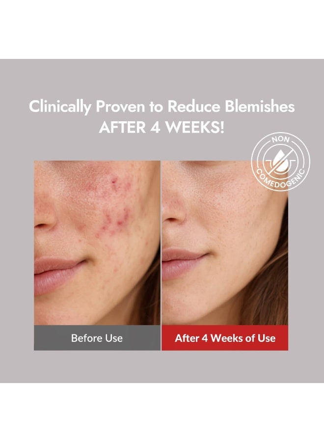 ميزون منظف ​​"Good Bye Blemish" من MIZON بتركيبة منخفضة الحموضة (Low pH)؛ منظف للبشرة المعرضة للمشاكل، وعلاج لحب الشباب والبثور، ومنتجات العناية بالبشرة الكورية، وعلاج موضعي للبثور، ومهدئ للبشرة الحساسة - 55 مل - Image 3