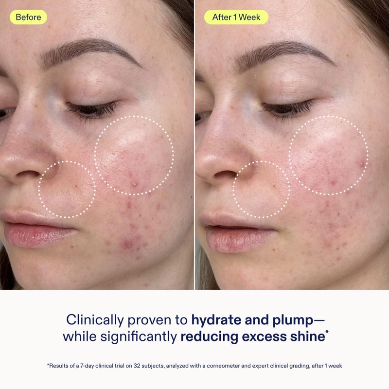 Skinfix جل كريم لإصلاح حاجز البشرة من سكين فيكس - 1.7 أونصة - مرطب غير دهني للبشرة العادية إلى المختلطة - يرطب، ويملأ، وينعم - غير مسد للمسام، خالي من العطور، نباتي، خالي من التجارب على الحيوانات - Image 3