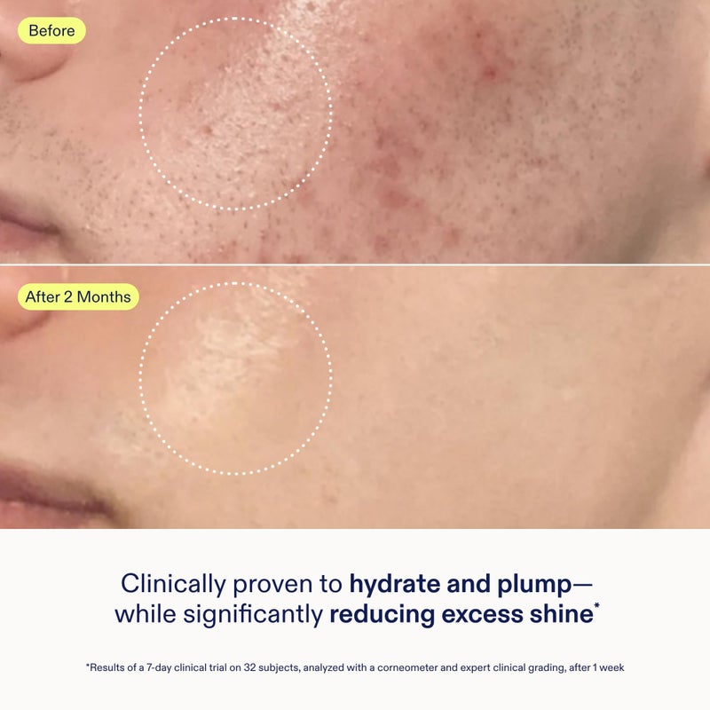 Skinfix جل كريم لإصلاح حاجز البشرة من سكين فيكس - 1.7 أونصة - مرطب غير دهني للبشرة العادية إلى المختلطة - يرطب، ويملأ، وينعم - غير مسد للمسام، خالي من العطور، نباتي، خالي من التجارب على الحيوانات - Image 4