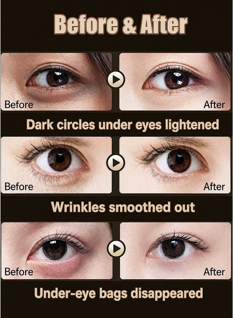 LYDIMOON Retinol Essence Eye Cream | Anti-Wrinkle, Firming & Repair 30g - Image 3