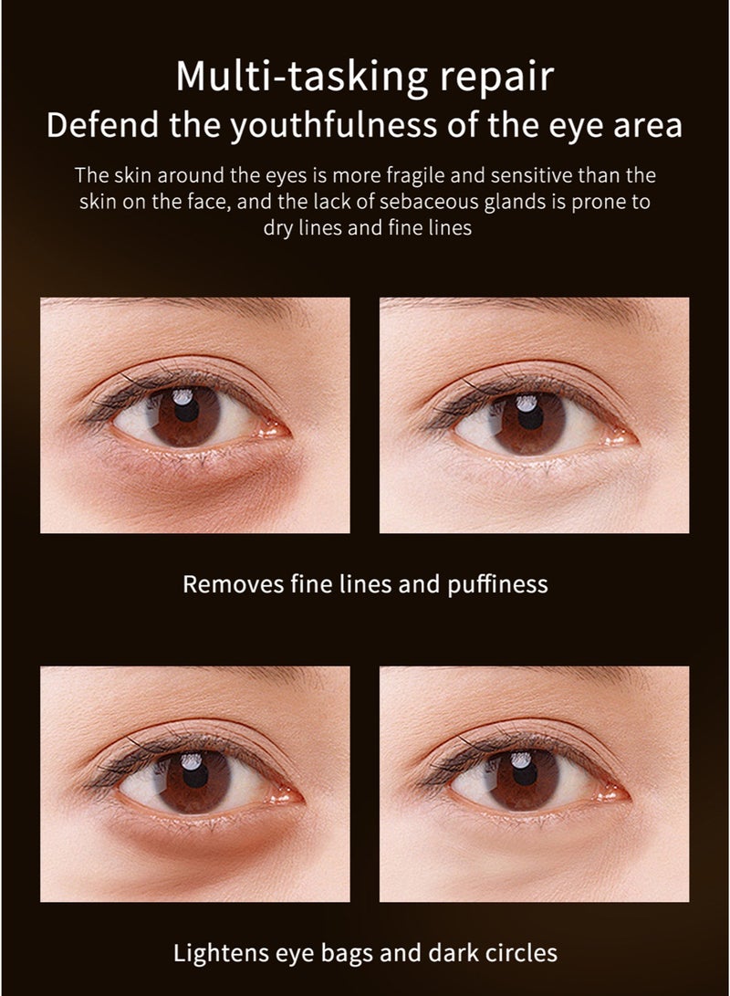 LYDIMOON Retinol Essence Eye Cream | Anti-Wrinkle, Firming & Repair 30g - Image 4