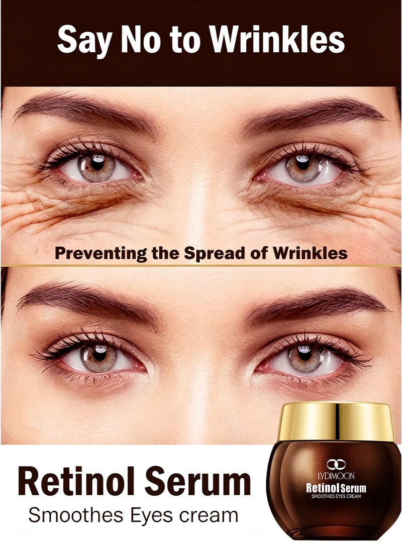 LYDIMOON Retinol Essence Eye Cream | Anti-Wrinkle, Firming & Repair 30g - Image 1