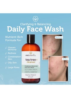 Era Organics Purifying Tea Tree Oil Face Wash - Balancing Cleanser For Oily, Blemish-Prone Skin With Salicylic Acid - Sulfate-Free, Fragrance Free, Made In Usa  - Image 4