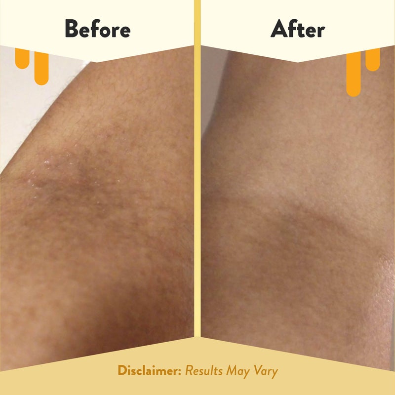 ECZEMA HONEY Fragrance-Free Oatmeal Comfort Bubble Bath - Sensitive Skin Body Wash & Bath Soak - Moisturizing Bath Products - Nourishing Bubble Bath for Women, Men, & Kids (12 Oz) - Image 4