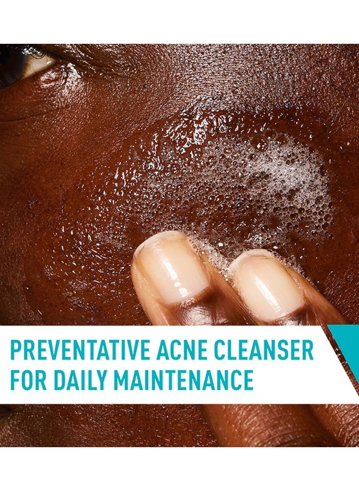 2% Salicylic Acid Acne Face Wash - Purifying Clay Cleanser for Oily Skin,16 fl oz - Image 4