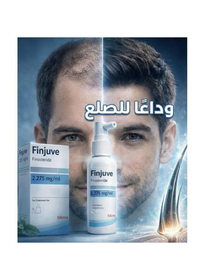 الحكمة بخاخ فينجوفي 2.275 مجم/مل الموضعي لعلاج تساقط الشعر - Image 3