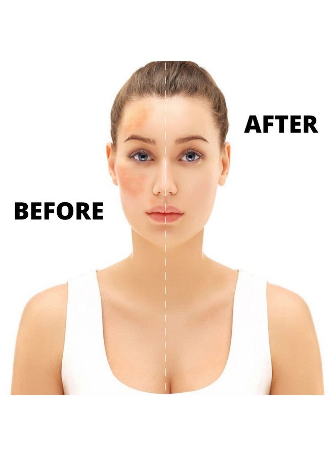 INTIMIFY زيت INTIMIFY للبقع الداكنة والندوب والتصبغ، كريم تفتيح وإشراق للوجه للنساء والرجال (30 مل - عبوة واحدة) - Image 3