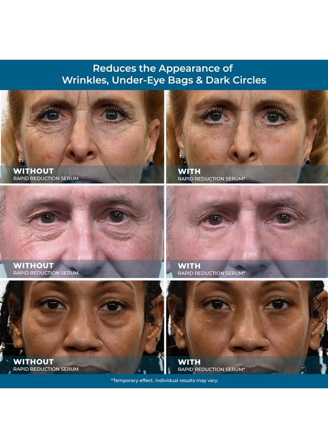 Plexaderm Rapid Reduction Eye Serum - Advanced Formula Anti Aging Visibly Reduces Under-Eye Bags, Wrinkles, Dark Circles, Fine Lines & Crow's Feet Instantly Instant Wrinkle Remover for Face - Image 4