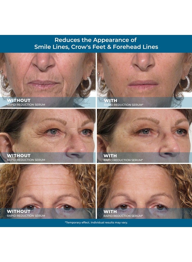 Plexaderm Rapid Reduction Eye Serum - Advanced Formula Anti Aging Visibly Reduces Under-Eye Bags, Wrinkles, Dark Circles, Fine Lines & Crow's Feet Instantly Instant Wrinkle Remover for Face - Image 5