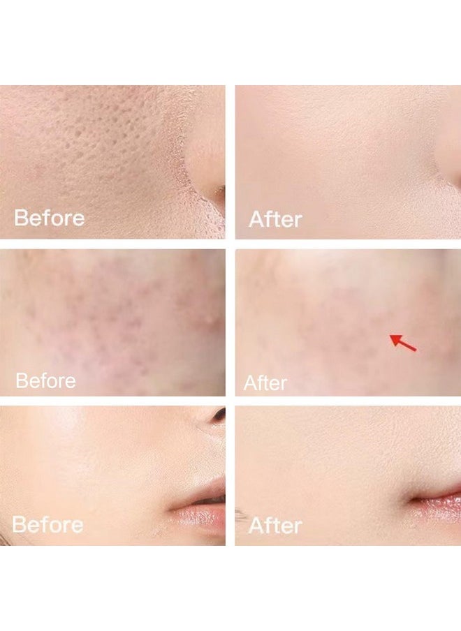 Rosarden - Niacinamide Serum For Face Anti Aging Serum Hydrating Serum For Moisturize Skin Oil Control Pores Reducer Reduces Skin Dullness And Delay Aging Niacinamide Face Serum For All Skin Type - Image 1