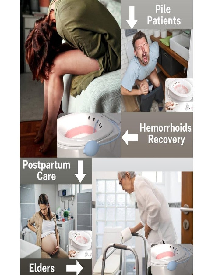 Wezone Sitz Bath Tub for Adults with Pressure Pump - Foldable Sitz Bath for Pregnant Women, Postpartum Care, Hemorrhoids, Piles & Anal Fissure Treatment | Fits All Toilet Seats (Multicolour) - Image 5