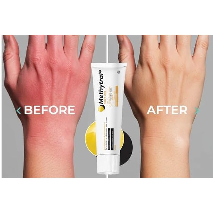 Methitral Soft Gel 50g - Image 2