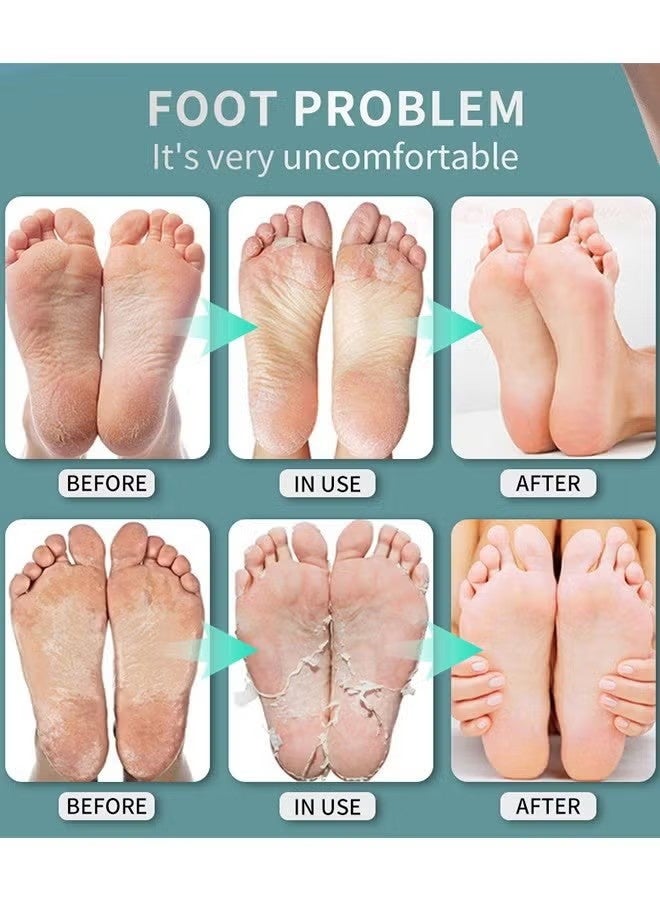 lansiyi Foot Bacteria Bacteriostasis Spray, Shoe Deodorizer Foot Spray Odor Smell Eliminator Freshener For Athlete Sweat Feet Skin Repair, Natural Ingredients Soothe And Feet Itchy Care Spray - Image 4