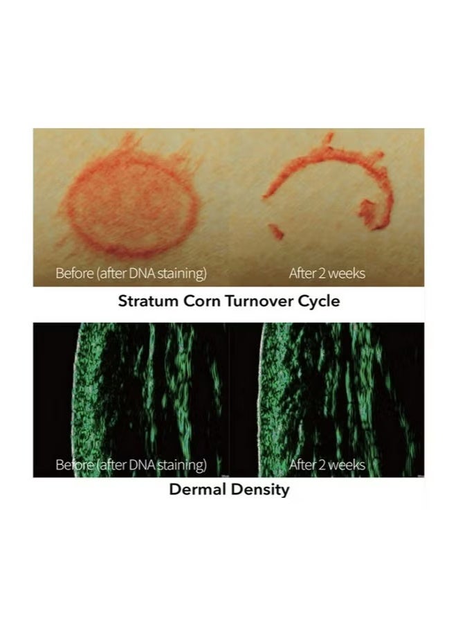 REJURAN Healer Turnover Ampoule Powerful Anti Aging Face And Neck Serum With Pdrn Hyaluronic Acid 30ml - Image 3