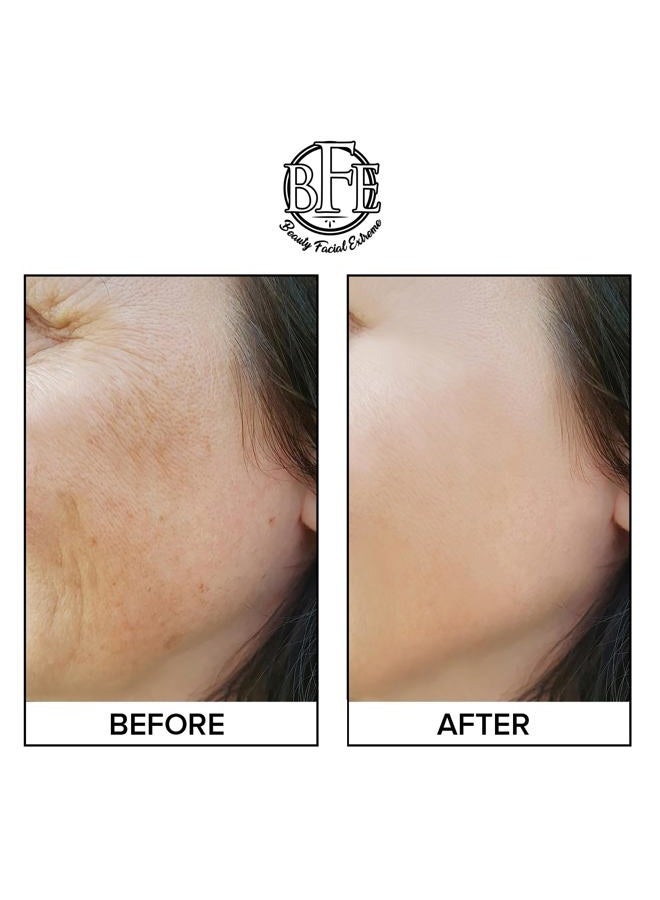 Beauty Facial Extreme Anti Aging Resurfacing Exfoliating Peel Pads Treatment- Contains Lactic, Salicylic, & Glycolic for Face & Body. Repairs Fine Lines, Wrinkles, Dark Spots, Pores, Acne Scars & Uneven Skin Tone. - Image 4