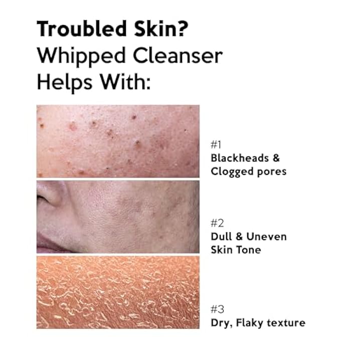 Troubless CLEAR PLUS Smooth Whipped Cleanser – Korean Skin Care Mask-to-Foam Facial Cleanser w/Vitamin C, Mung Bean, Kaolin Clay & PHA – Pore-Refining & Hydrating Face Wash (2.70 fl oz) - Image 3